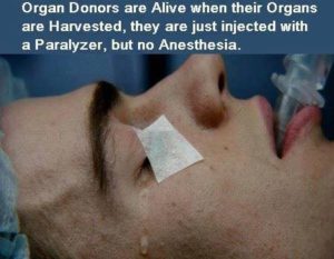 Organ Harvesting