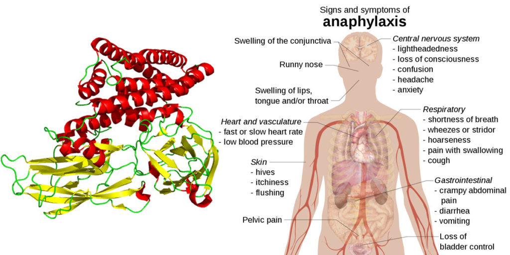 GM Bt toxin is immunogenic, allergenic, and causes pre-cancerous intestinal changes