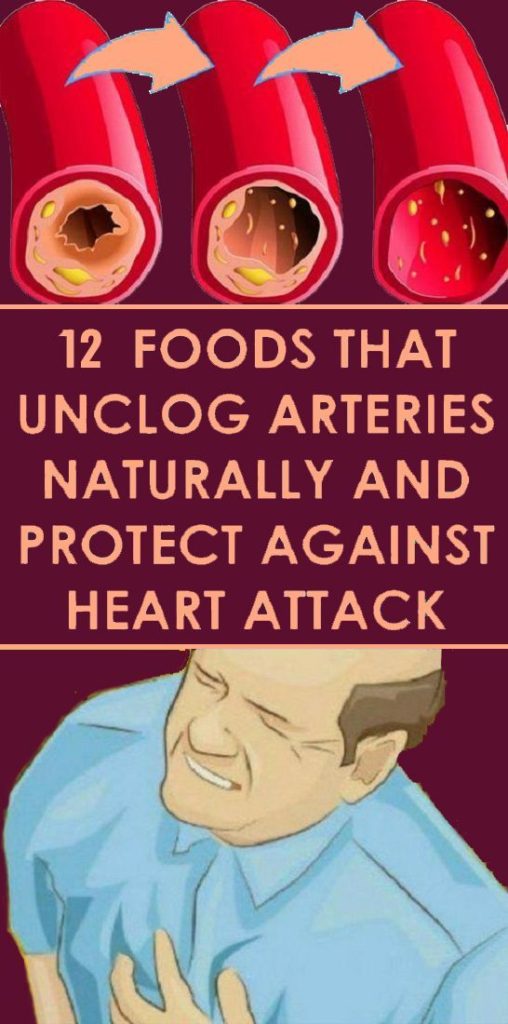 Healthy Foods To Reduce Clogging Of Arteries