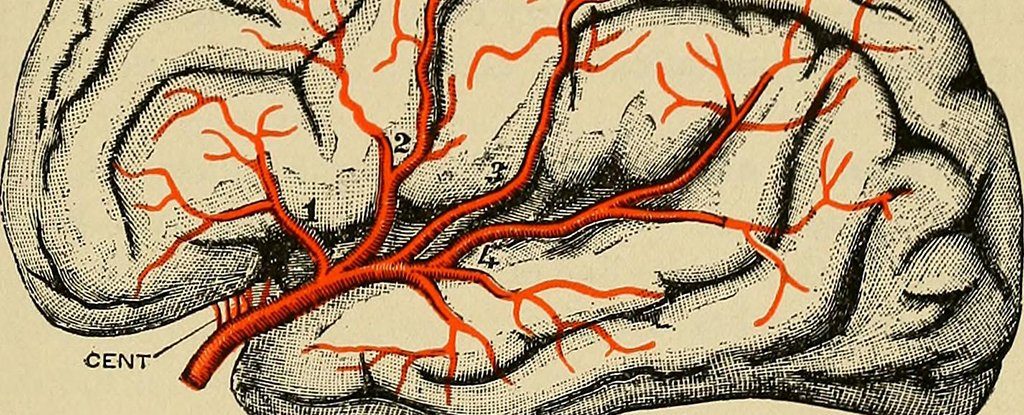 parkinsons disease drawing