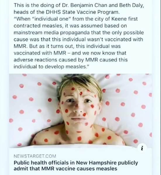 MMR Causes Measles