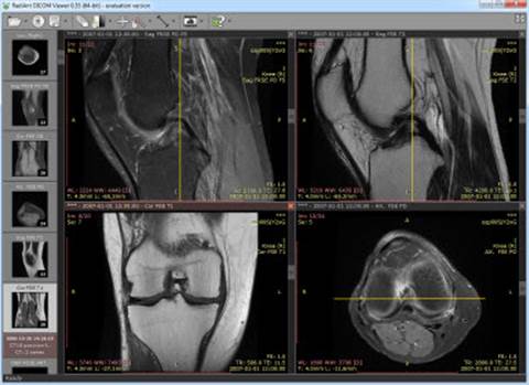 Medical Image