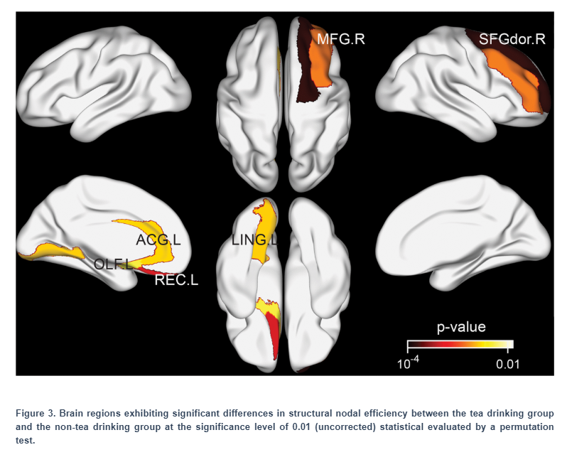 Brain_Images