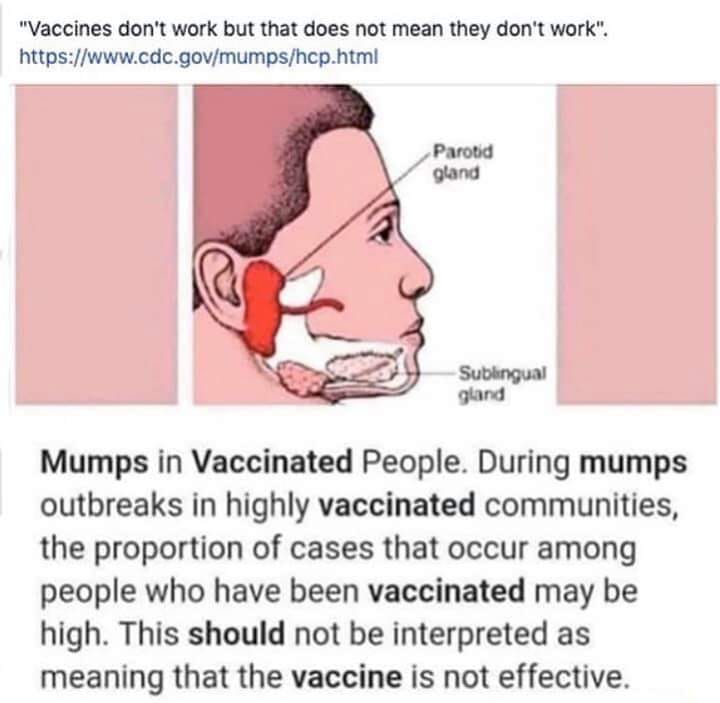 Mumps