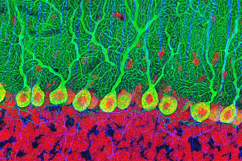 purkinje_nerve_cells_in_the_cerebellum
