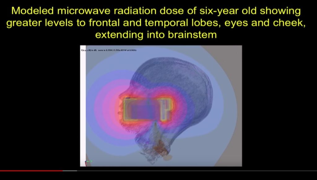 Microwaving The Brain