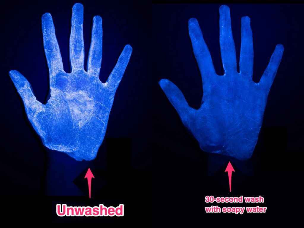 Photos show hand sanitizer doesn't work as well as soap and water to remove germs