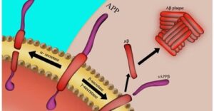 The Gut Alzheimer's Link