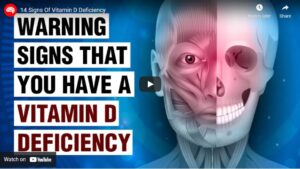14 Signs Of Vitamin D Deficiency