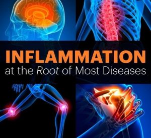 Inflammation-The Root Of Most Diseases