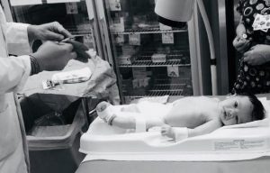 Baby Circumcision