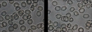 Blood Cell Comparison