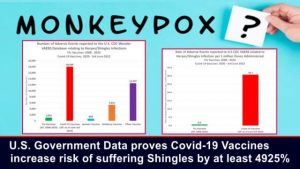 monkeypox shingles