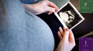 Pregnant Belly Ultrasound