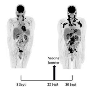 Pre And Post Booster Cancer Comparison