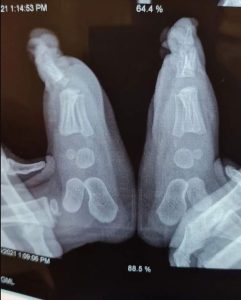 X-Ray Baby Feet