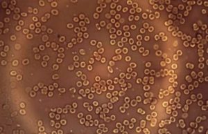 Blood Cells Normal
