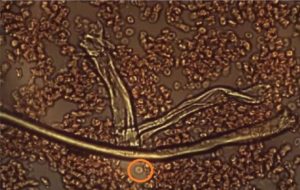 Blood Cells Plus Graphene Oxide