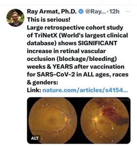 Post Jab Increase In Retinal Vascular Occlusion