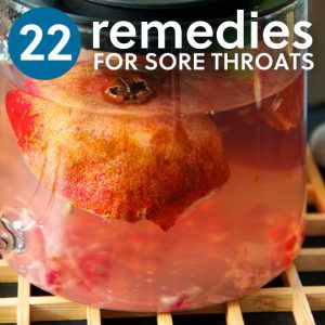 22 Sore Throat Remedies