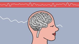 Brain Wave Monitoring