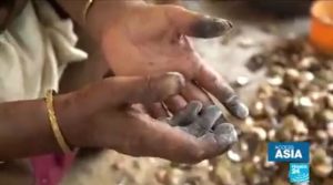 Oxalate Damaged Hands