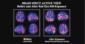 Red Dye Affected Brain