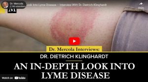 Lyme Disease Bullseye Rash