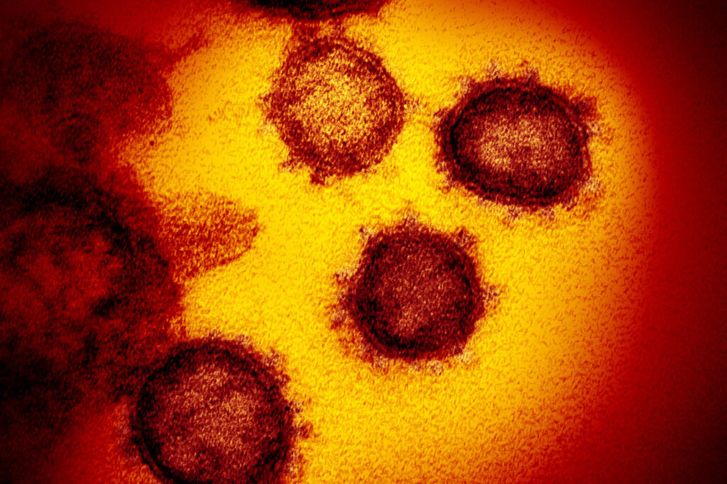 Coronavirus EM Image