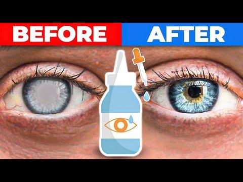 Cataracts Before and After