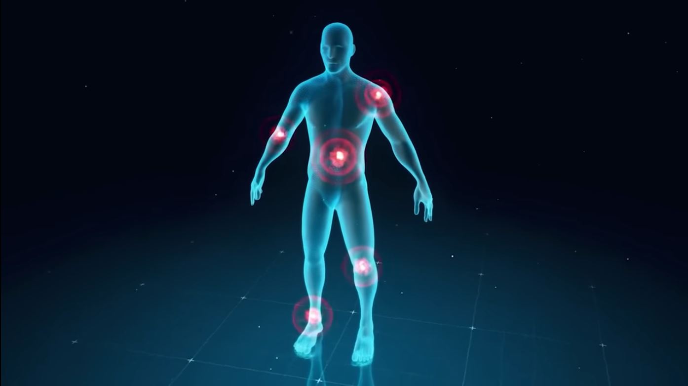 Body Inflammation Points