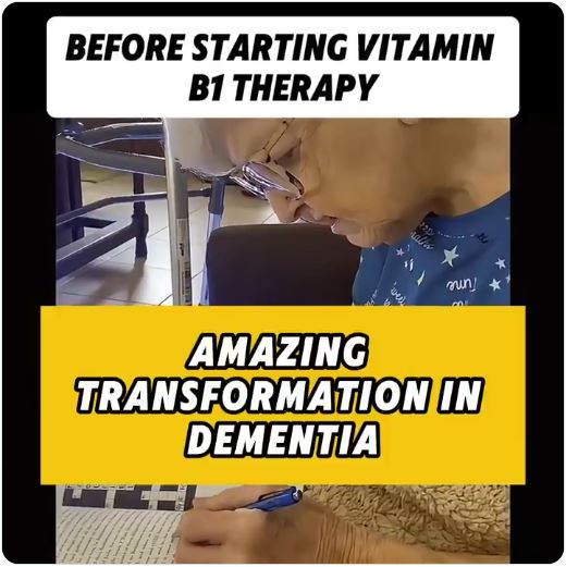 Vitamin B1 Therapy for Dementia