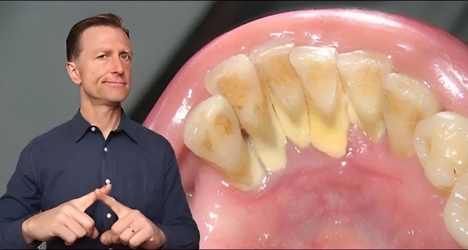 Dr Berg On Tooth Health