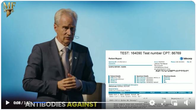 Spike Protein Antibody Test