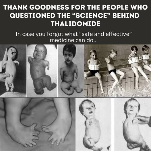 Thalidomide Babies