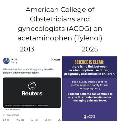 ACOG On Acetaminophen