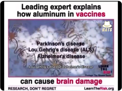 Aluminium In Vaccines Damages Brains