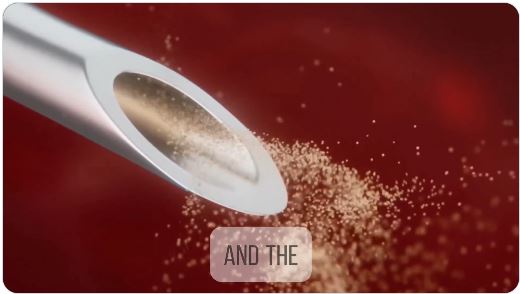 Lipid Nanoparticles