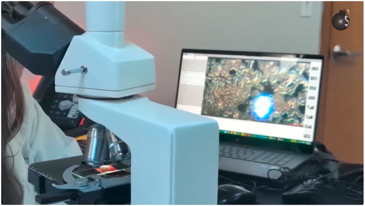 Clumped Blood Cells And Technology