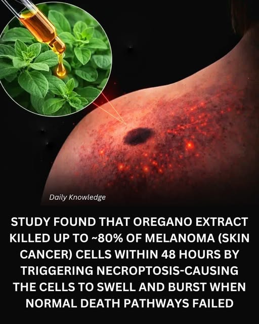 Oregano vs Melanoma