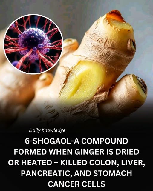 Anti-Cancer Ginger