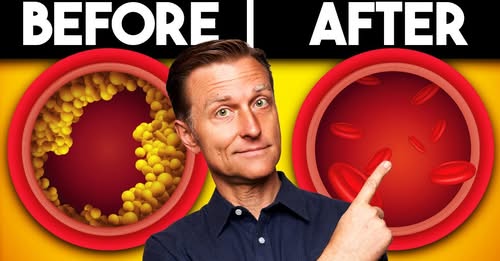 Arteries Before and After