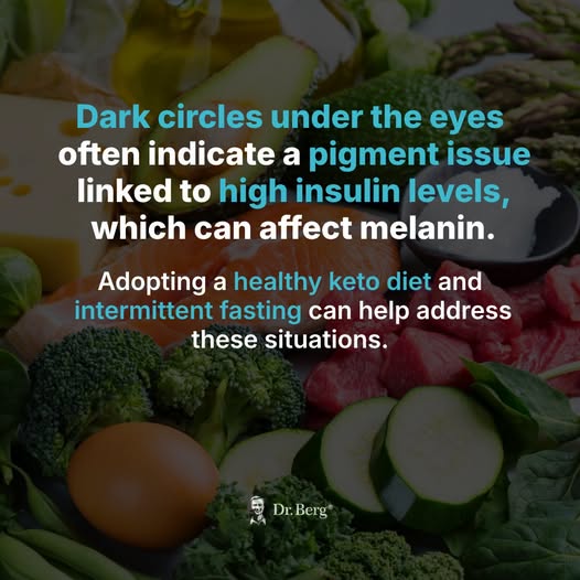 Dark Circles